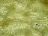 7 - Cellule corticali in visione superficiale